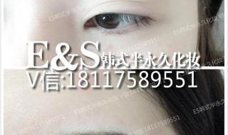 秀眉的价格 秀眉的价格